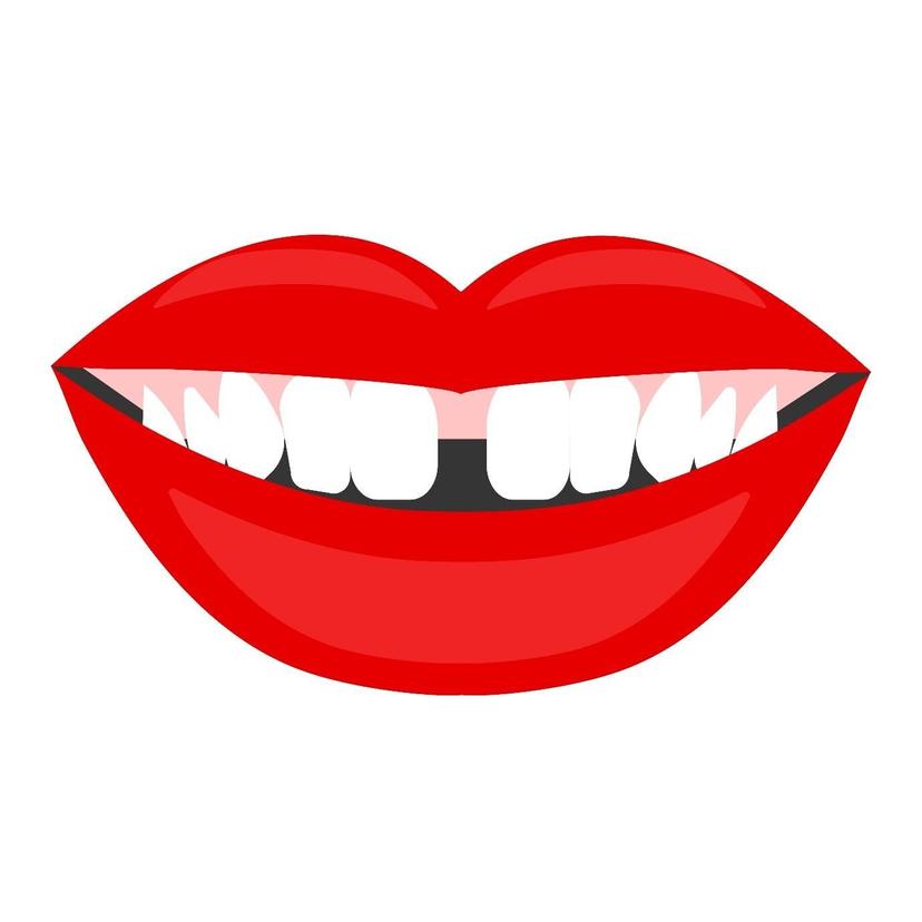 Teeth Gap Not a Problem Anymore! Here's How!