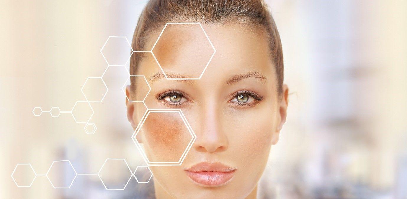 skin discolouration