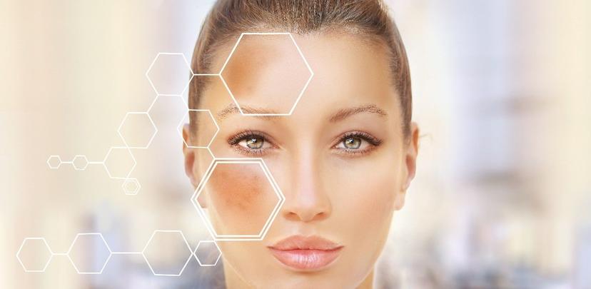 All You Need To Know About Pigmentation on Skin and Its Treatments