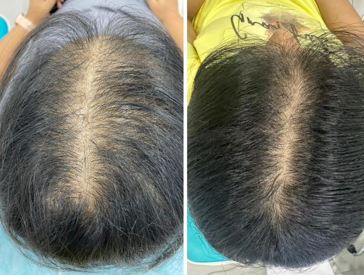 before-after