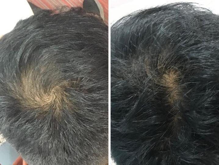 before-after