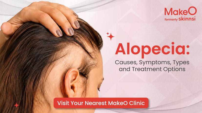 Alopecia Explained: Causes, Types & Treatment Options