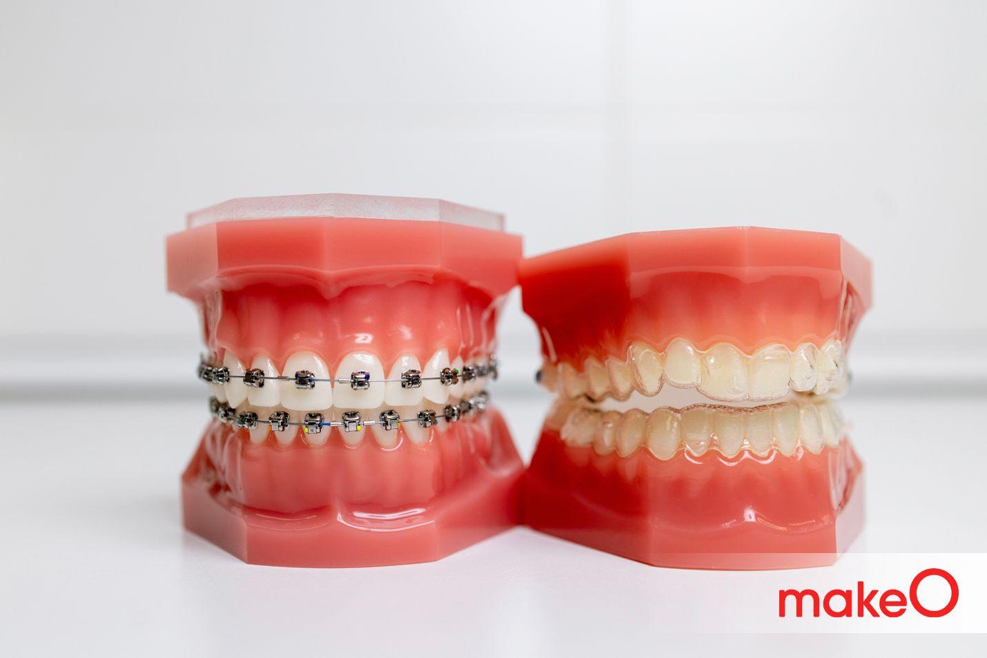 different types of teeth