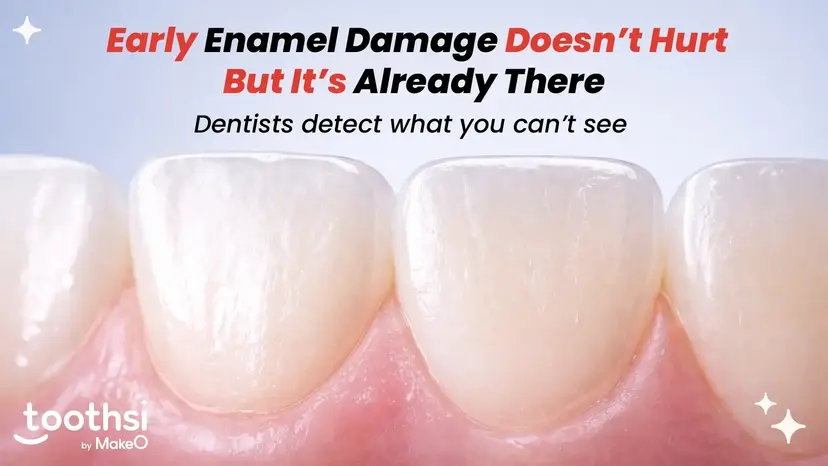 How to Detect Early Signs of Tooth Enamel Damage