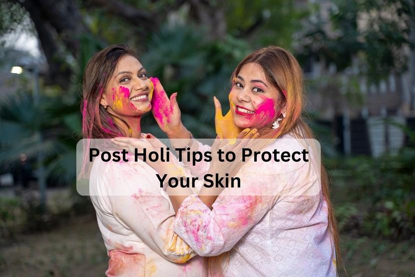 8 Post Holi Skin Care Tips You Must Follow to Avoid Any Skin Damage