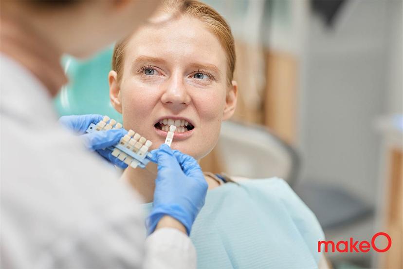 A Guide to Dental Crowns or Teeth Cap