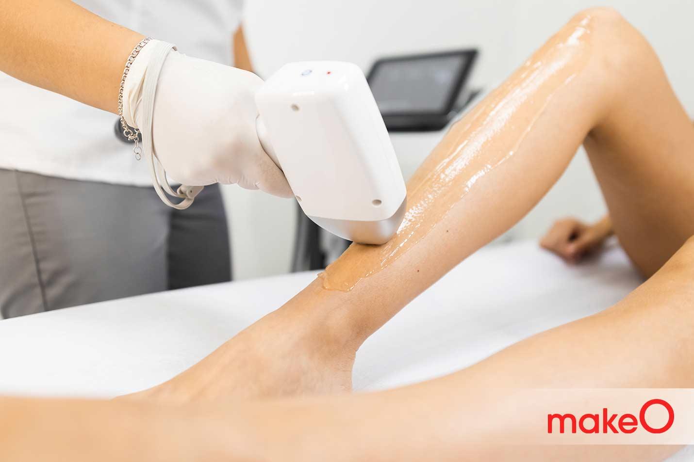 Diode Laser Hair Removal Treatment
