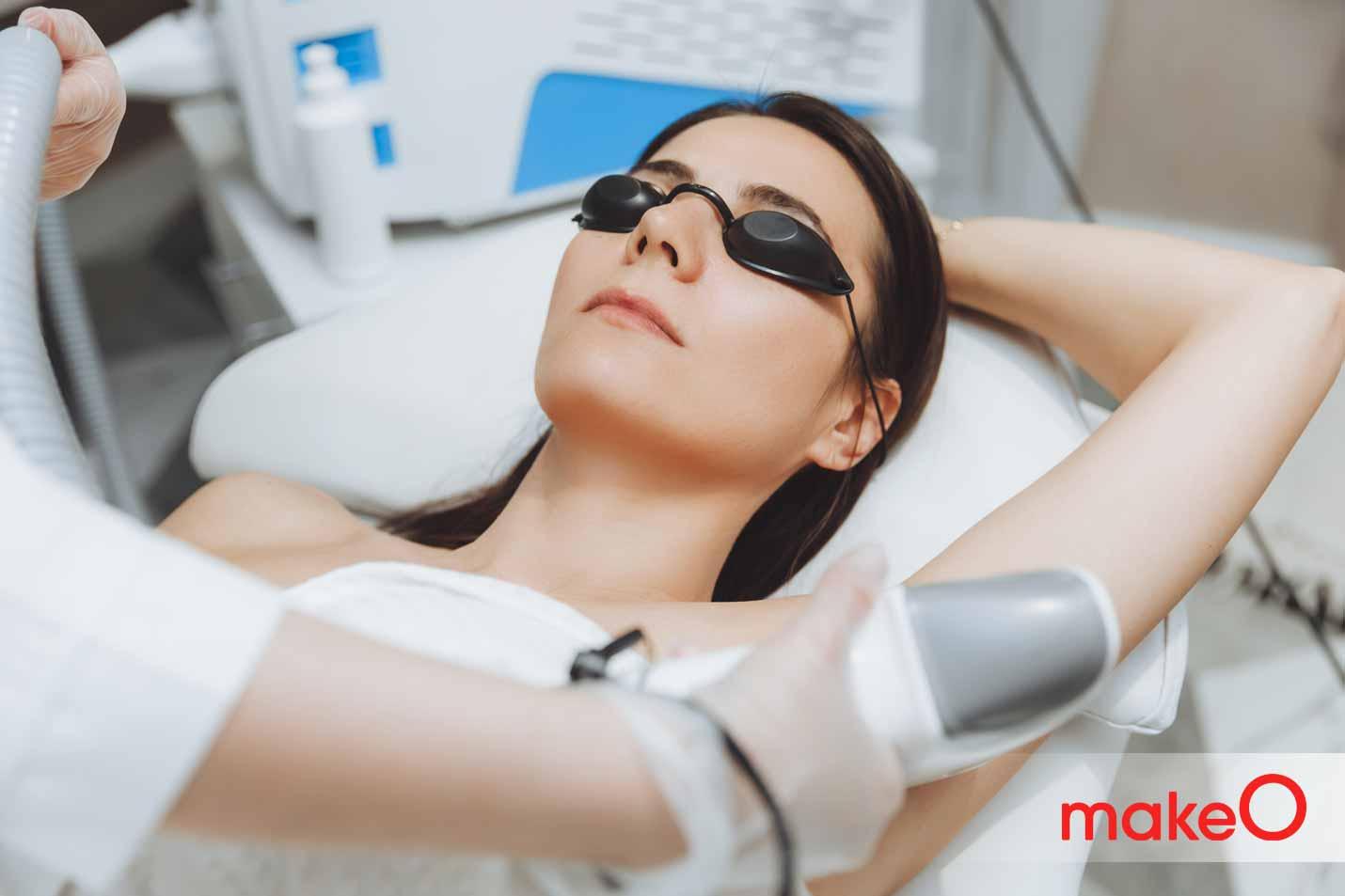 laser hair removal underarm