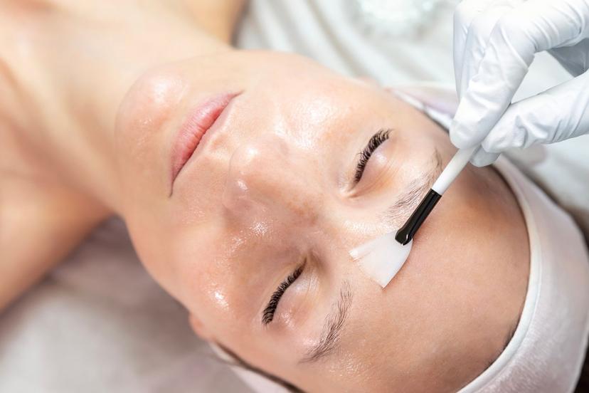 How often should you get chemical peel treatments done?