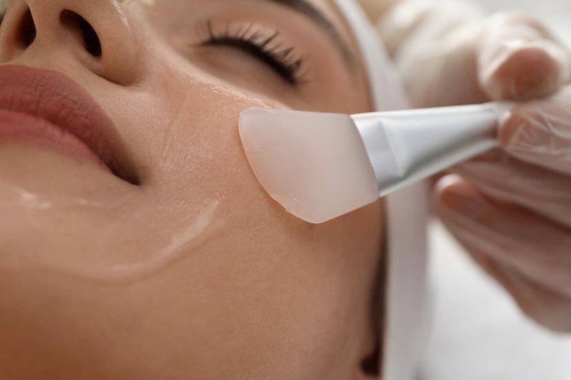 All You Need to Know About Chemical Peels: A Guide