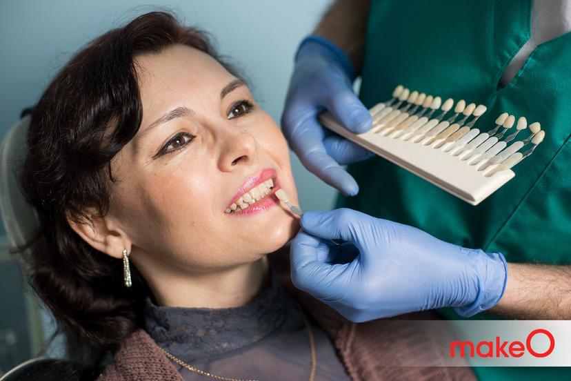 Cosmetic Dentistry: 5 most popular cosmetic procedures for your teeth?