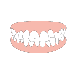 teeth_modal