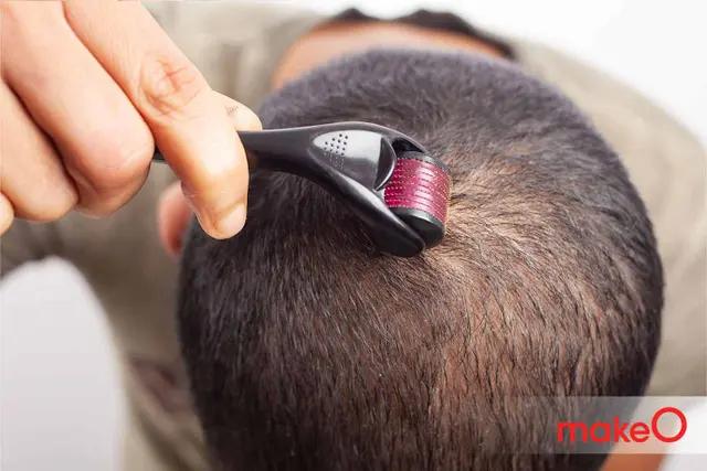 Hair Revival: How to Use Derma Roller For Hair