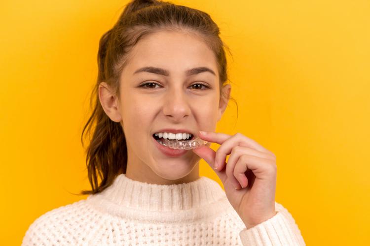 kids aligners