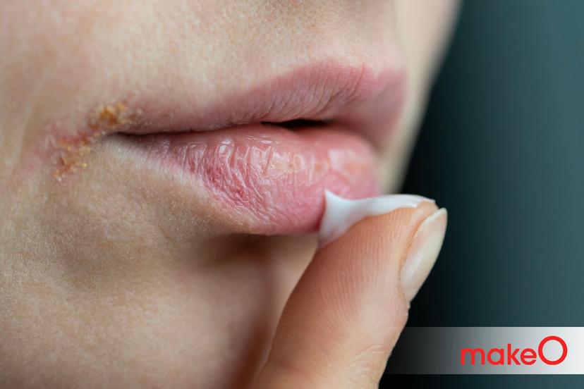 Dry Mouth:Understanding the Common Causes and Home Remedies