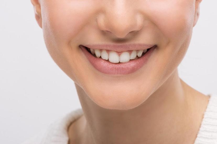 Wondering How Long Do Braces Take to Give a Celeb-Like Smile? Here Is a Comprehensive Guide on The Same