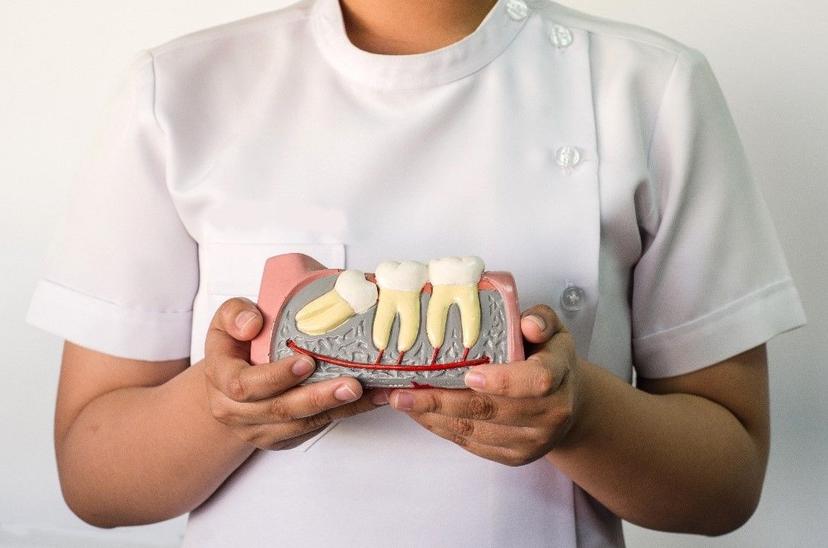 Your Complete Guide to Impacted Teeth