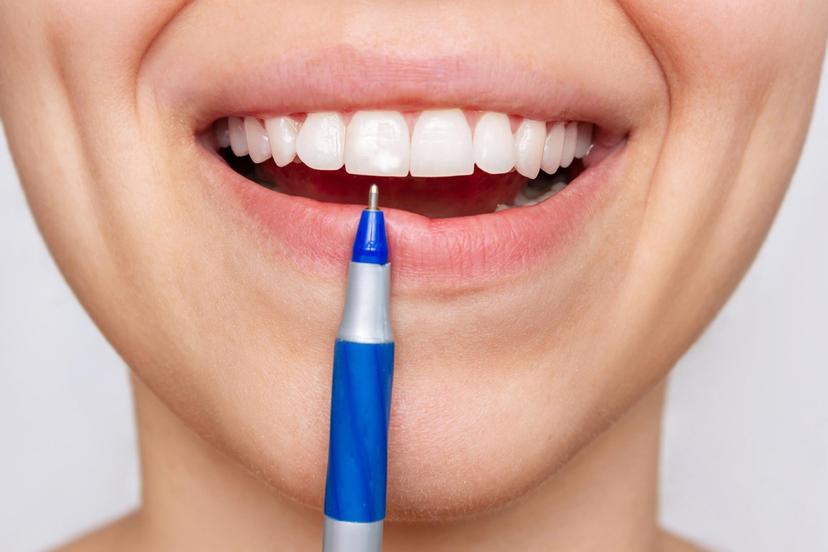 How Does a Teeth Whitening Pen Work?