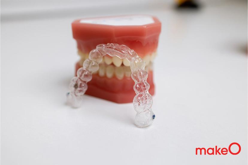 4 Types of Mouthguards You Should Know About