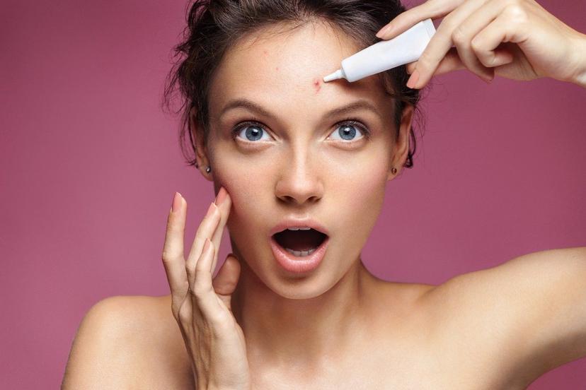 Teenage Acne: All You Need To Know About Teenage Pimples