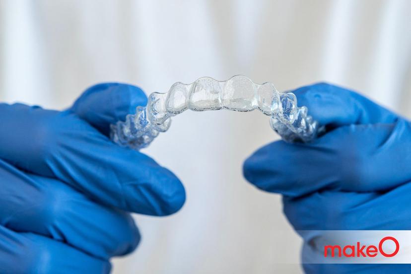 7 Care Tips You Should Know for Kids' Retainers