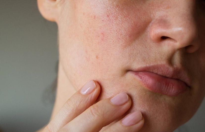 Ways to Keep Sensitive Skin Symptoms Under Wrap
