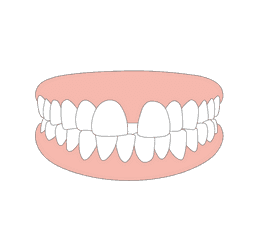 teeth_modal