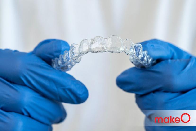 Answering All The FAQs on Dental Retainers