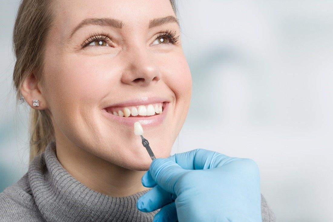 teeth veneers benefits