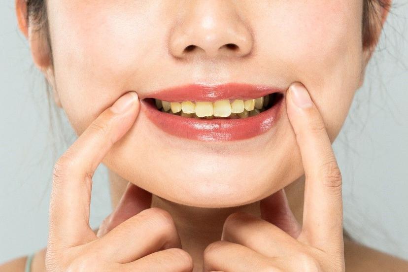 Learn How to Prevent and Treat Tooth Discoloration